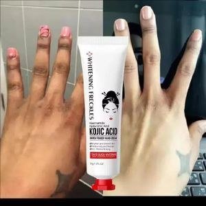 Kojic Acid-Labelled Hand-Cream Tube