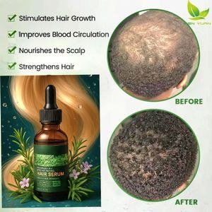 Rosemary Organics Oil Strengthening Hair Serum – Repairs Damaged Hair, Boosts Growth & Shine