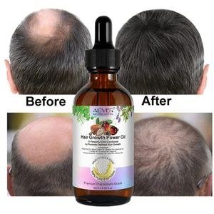 Aliver 100% Pure Natural Vegan Fast Power Mix Oil - 60mls