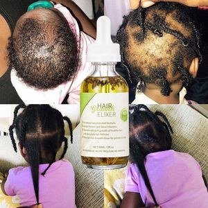 Natural Beauty Best Organic Rosemary Herbs Hair Oil Scalp Treatment Fast Baby Oil for Black Women