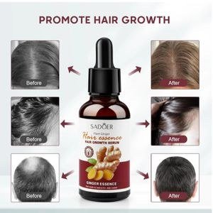 7 Day Ginger for Hair and Scalp, Serum, Against Hair Loss, Hair Strengthening Oil for Healthy